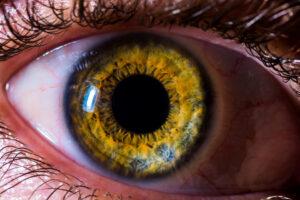 iris dilated pupil